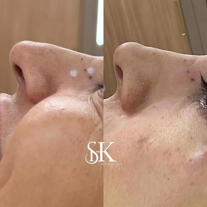 Resultados 1 SHK Odontologia