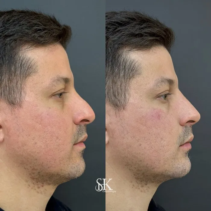 Resultados 4 SHK Odontologia