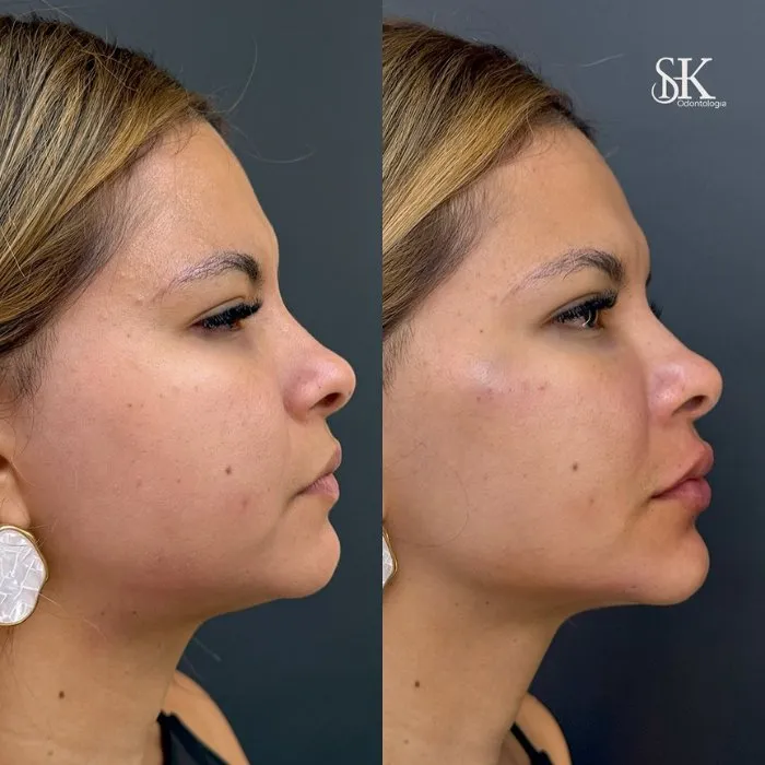 Resultados 5 SHK Odontologia