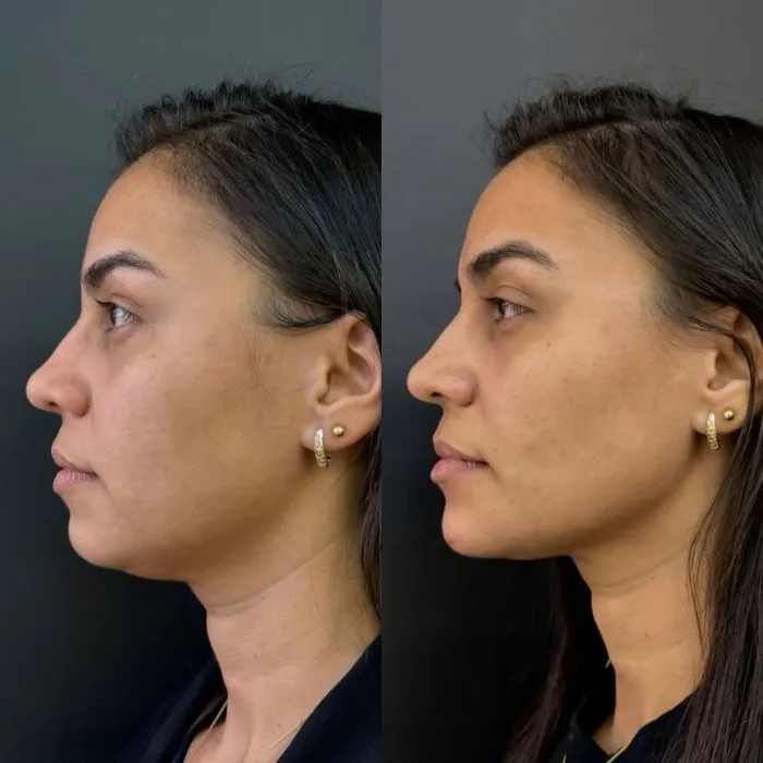 Resultados 6 SHK Odontologia